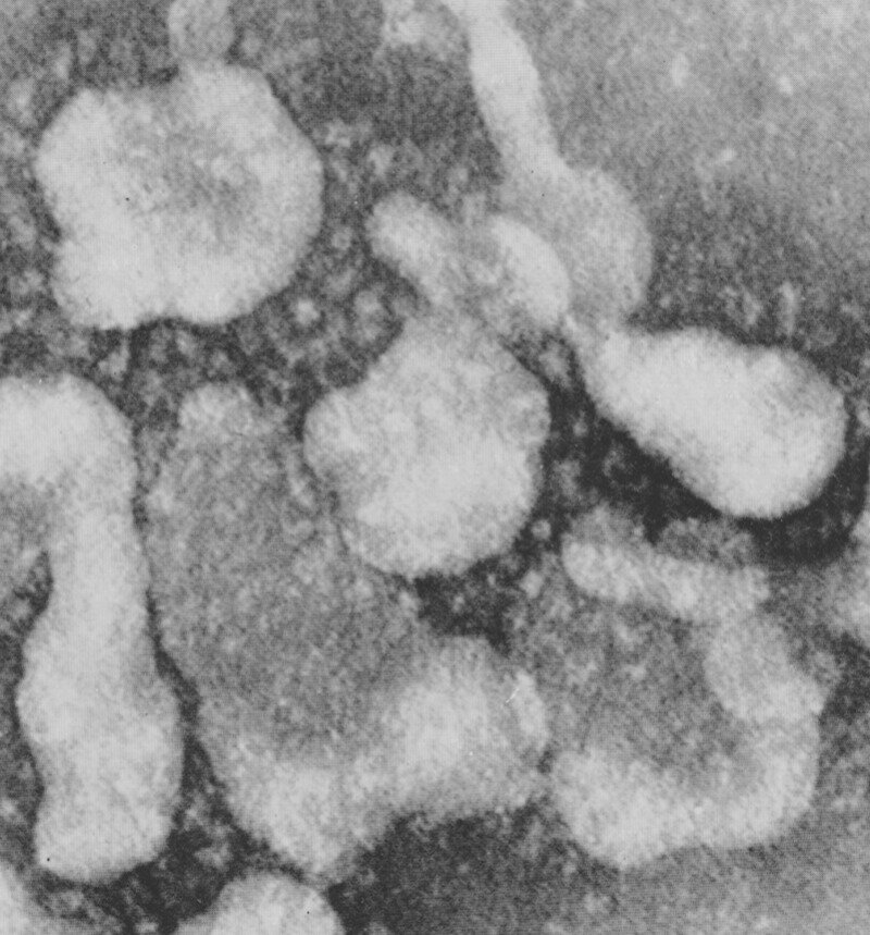 Photo: Centers for Disease Control and Prevention